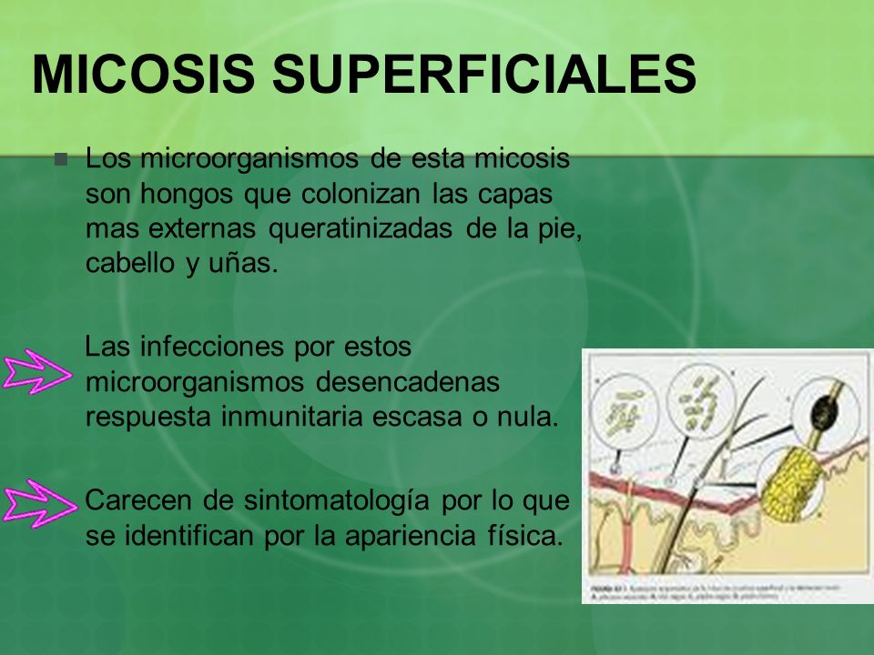 que son micosis cutaneas que son micosis cutaneas
